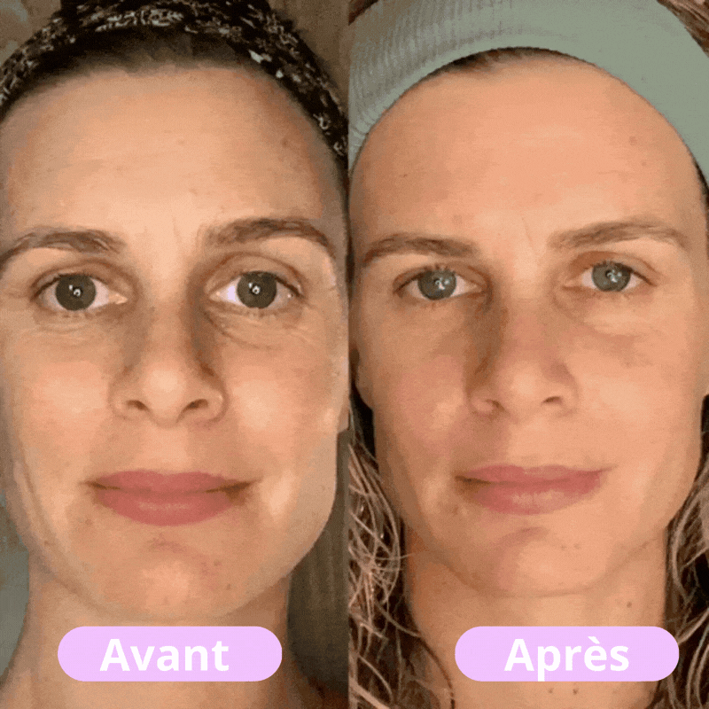 Avirly - Masseur facial LED tonifiant